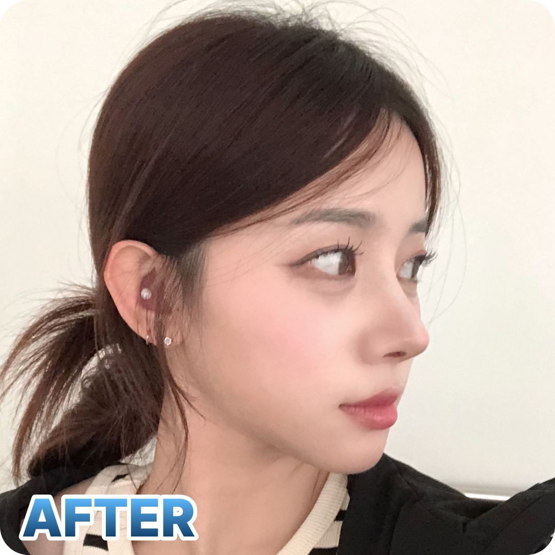 After
