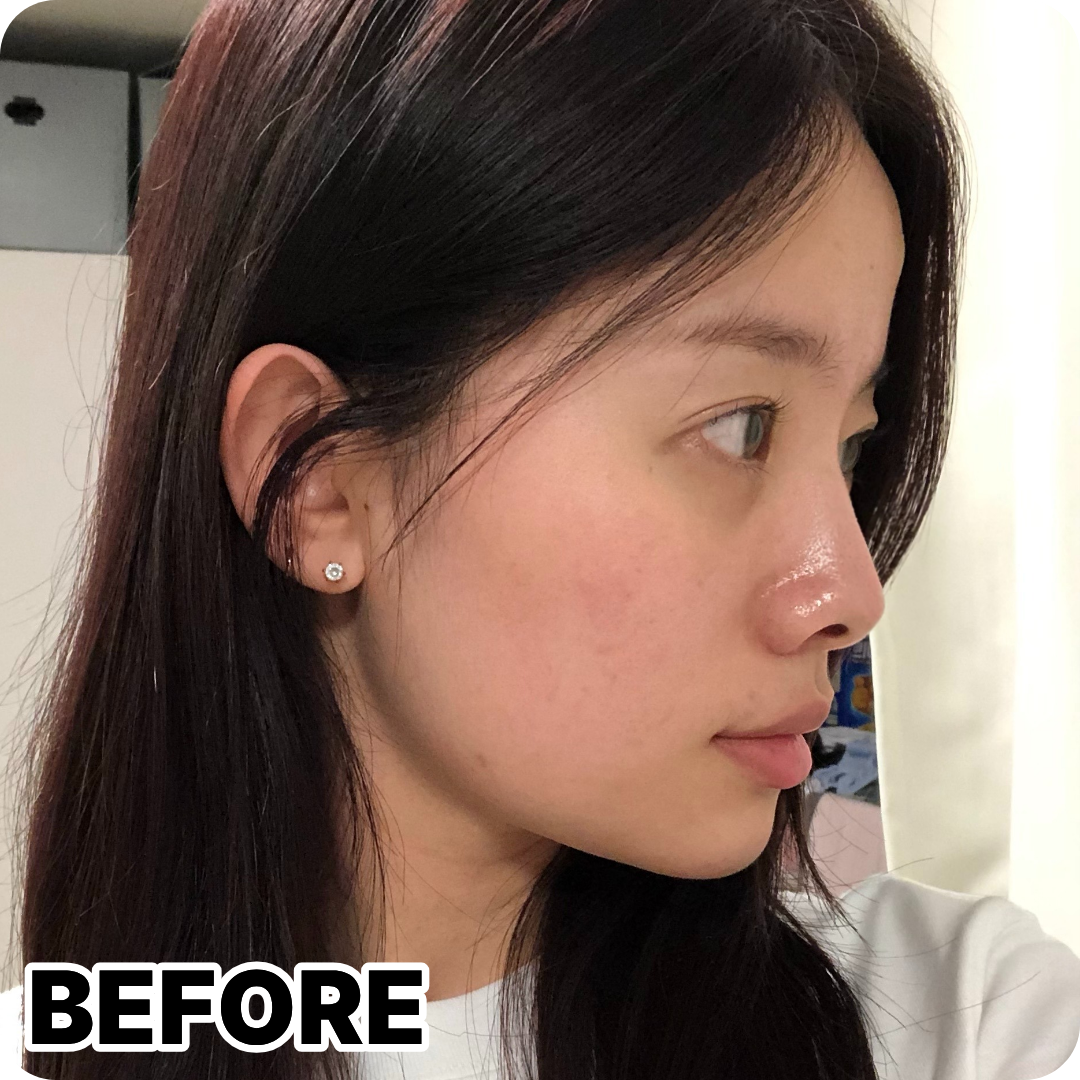 Before